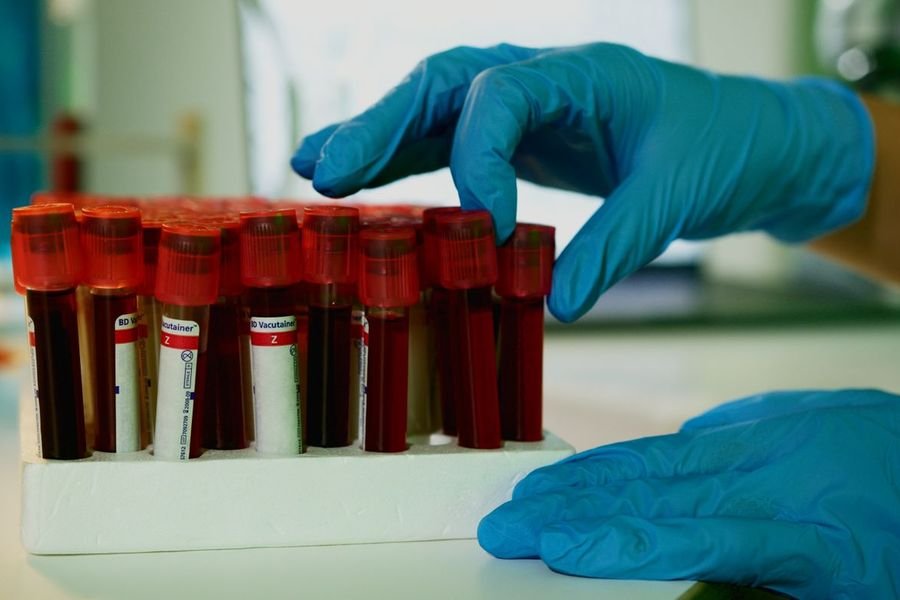 Blood samples in a pathology lab
