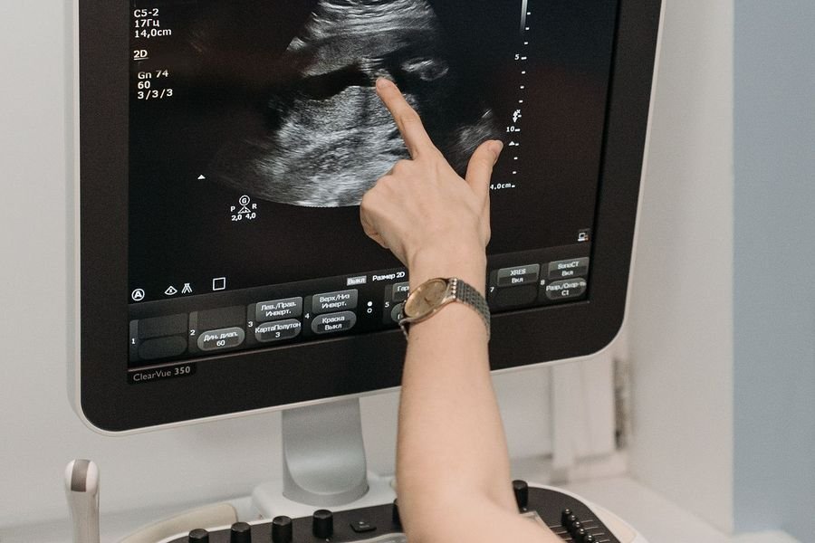 Ultrasound scan on screen